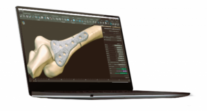 3D Printing in Orthopedic Rehabilitation