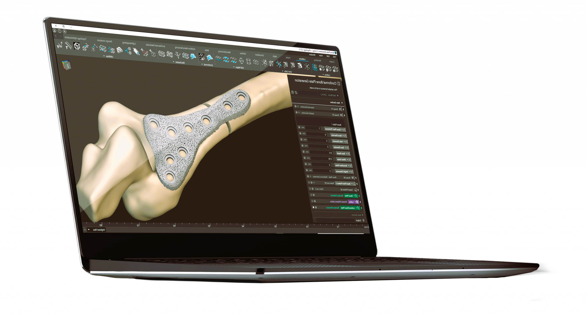 3D Printing in Orthopedic Rehabilitation